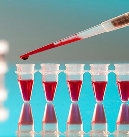ΠΑΝΟΥ ΜΑΡΙΑ  - ΜΙΚΡΟΒΙΟΛΟΓΙΚΟ ΕΡΓΑΣΤΗΡΙΟ ΦΕΡΕΣ ΕΒΡΟΥ - ΜΙΚΡΟΒΙΟΛΟΓΟΣ ΒΙΟΠΑΘΟΛΟΓΟΣ ΦΕΡΕΣ ΕΒΡΟΥ